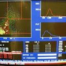일반 혈액 검사(Complete blood cell count, CBC) 이미지