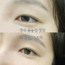 청주 반영구 눈썹 문신 리터치 포함 10만원 말이 돼!? 금손 아이뷰티 후기