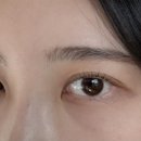 오드아