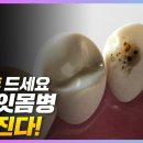 잇몸병에 양치 후 양파, 비타민 씨든 과일, 가지를(뚱뚱한 한의사 이미지