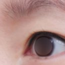 이든 F&O | 연예인 눈 만드는 앞트임+쌍수 절개 재수술 (전후 후기)