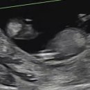 닥터황여성의원 이미지