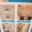 퀸도테라 - 28260 | 퀸도테라
