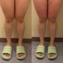 다온에스테틱 | 하체관리 잘하는 중랑구 에스테틱 다온미에스테틱 솔직 후기