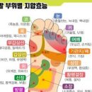 발바닥 굳은살 티눈 원인 및 통증 가려움 각질 제거 방법 이미지