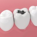 연세뉴욕치과의원 이미지