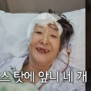 배우윤석화 뇌종양 수술후 앞니 싹다빠져 젖병사용 이미지