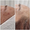 미더베스트마곡점 | 마곡피부관리 미더베스트 관리받는 내내 만족스러운 곳