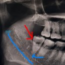 죽파치과 이미지