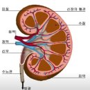 물혹,낭종(외낭종,내낭종) 이미지