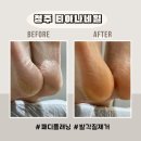 플러스약국 | 청주 발각질 관리 티아나네일 패디플래닝 만족 후기