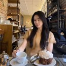 신사역 여드름 흉터 제거 엑셀브이성형외과 후기 / 신상성형외과