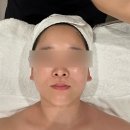 평촌피부관리 맘스킨뷰티 스페셜페이스 관리 후기