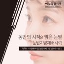더이노써클