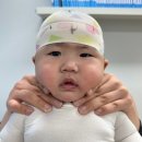 이노야드 두상교정센터 석촌호수 네이버블로그