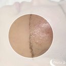 어뮤즈네일 이미지
