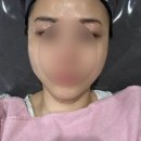 더 예쁨 | 성남피부관리 신흥동 에스테틱 [더예쁨] 관리 후기