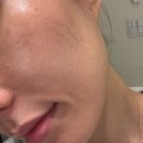 타라 | 성북구피부관리 추천 타라테라피 후기