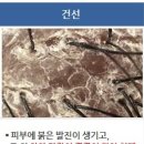피아체헤어