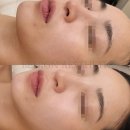 비나인에스테틱 이미지