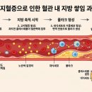 아무 증상도 없는데 혈관이 막히고 있다고요?고지혈증의 무서운 진실 이미지