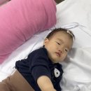 세븐일레븐 강릉아산병원점 | 강릉아산병원 응급실 11개월 아기 열상(머리 이마쪽 찢어진 상처) 봉합 후기