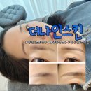 아롬4579,토탈뷰티 | 대전눈썹반영구 눈썹문신잘하는곳 더나인스킨 인생눈썹찾기