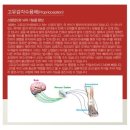 특수보행매트 (보행운동, 수술후재활, 발목염좌, 무릎재활, 고관절재활) 이미지