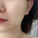 크로바호텔 | 괴정동피부관리 추천 바른결에스테틱 속건조장벽케어 후기