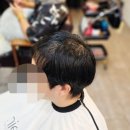 천안 링거펌 후기｜바코드 앞머리·정수리 탈모 고민, 수원까지 찾아온 30대 남성의 변화