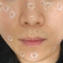 아가파의원 | 얼굴 점제거 후기 주안 아가파의원 대기시간 통증 관리까지 솔직 리뷰