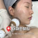 상상146 | 수원 인계동에스테틱 더마인뷰티 : 이중턱, 팔자주름 고민 해결 온다 리프팅 후기