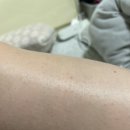 H3210 | 내돈내산 1달 사용후기 - 집에서 쓰는 실큰 쥬얼 IPL 제모 의료기기