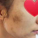 월산원광한방병원 이미지