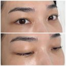 라인 | 대구 칠곡 속눈썹 연장 자연스러운 속눈썹펌 헤어라인 후기 / 래쉬홍