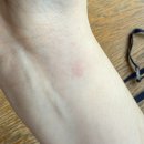 초록한의원 | 예본한의원 8체질 검사 최종진단, 생리통 해결한 후기