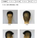 브로스컷 이미지