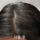 지성두피 기름진 떡진머리 구원템 추천 | 다이소 윙크걸 헤어노세범파우더 내돈내산 후기