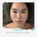 자연이연 | 김포 피부관리 추천｜출산 후 무너진 턱선, 이연 에스테틱 솔직 후기