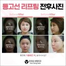 윤정섭성형외과의원 | 합정역리프팅 동안외모를 원한다면 이곳으로