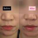 양덕동207 | 마산피부관리 온본에스테틱 LDM 케어 솔직후기