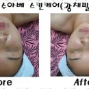 문스킨케어 이미지