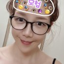 Zoom안경콘택트 | 스마일라식 + 각막강화수술 후 1주일 후기 회복 진행중_ 일상블로그