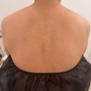 스킨엔(Skin N) | 대구수성구 어깨관리, 마사지로도 무거웠던 40대 여성 써마웨이브 (온다리팅)바디 3회 후기