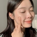 서현어린이집 | 분당 서현역 피부과 가성비 좋은 미백관리 피코토닝 레이저 후기