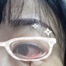 송우신안과의원 이미지