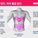 명치약국 이미지