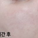 블링업