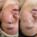 8064회 비올로직호쉐쉬 케어한 보떼비알 General Manager 홍당무 피부 1:1 커스터마이징케어