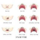 구순열(Cleft lip) 성형미용, 소아청소년질환 이미지